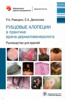 Рубцовые алопеции в практике врача-дерматовенеролога. Руководство для врачей