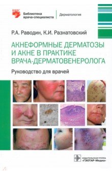 Акнеформные дерматозы и акне в практике врача-дерматовенеролога. Руководство для врачей