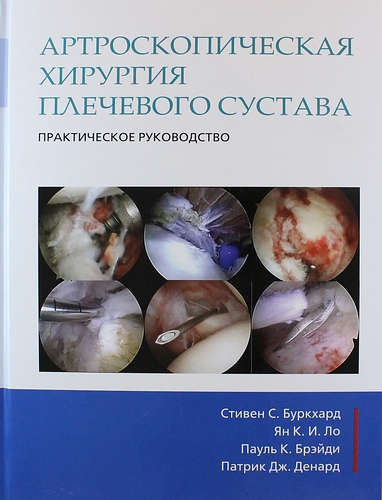 Артроскопическая хирургия плечевого сустава. Практическое руководство