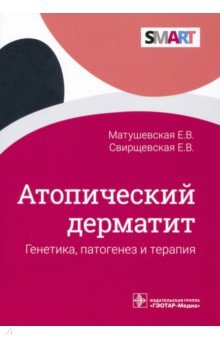 Атопический дерматит. Генетика, патогенез и терапия