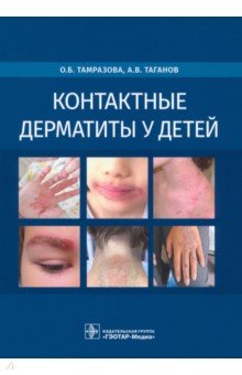 Контактные дерматиты у детей