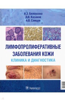 Лимфопролиферативные заболеванания кожи. Клиника и диагностика