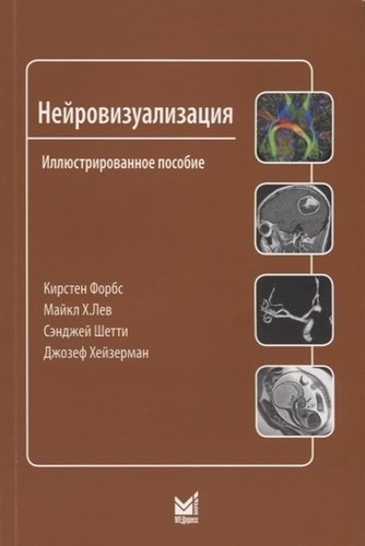 Нейровизуализация