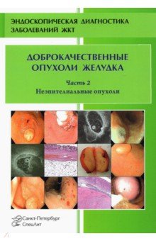 Доброкачественные опухоли желудка. Часть 2. Неэпителиальные опухоли