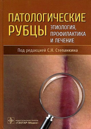 Патологические рубцы Этиология профилактика и лечение