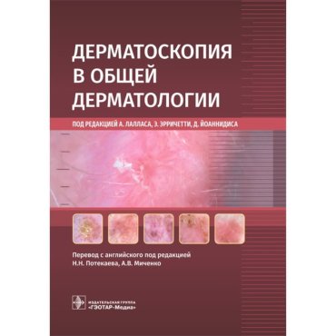 Дерматоскопия в общей дерматологии. Под ред. Лалласа А.
