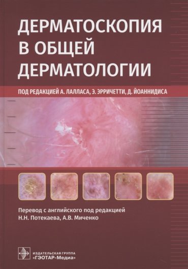 Дерматоскопия в общей дерматологии