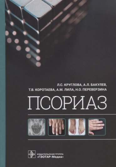 Псориаз