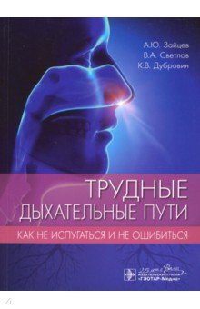 Трудные дыхательные пути. Как не испугаться и не ошибиться