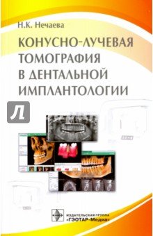 Конусно-лучевая томография в дентальной имплантологии