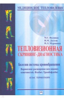 Тепловизионная скрининг-диагностика. Болезни системы кровообращения. Варикозное расширение вен