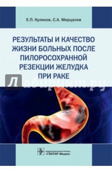 Результаты и качество жизни больных после пилоросохранной резекции желудка при раке