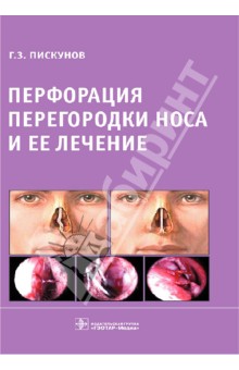 Перфорация перегородки носа и ее лечение