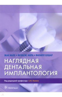 Наглядная дентальная имплантология