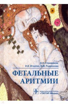 Фетальные аритмии
